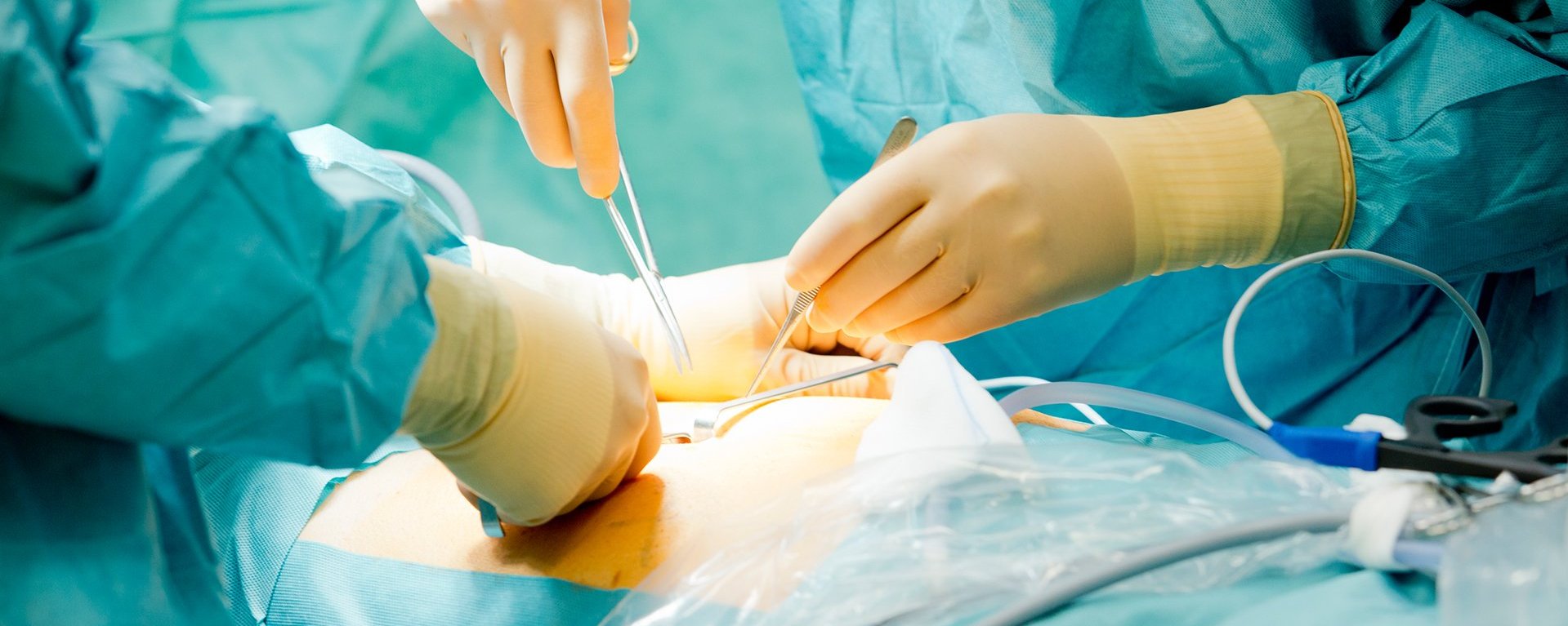 Operation bei in der Allgemein- und Viszeralchirurgie in Ottobeuren