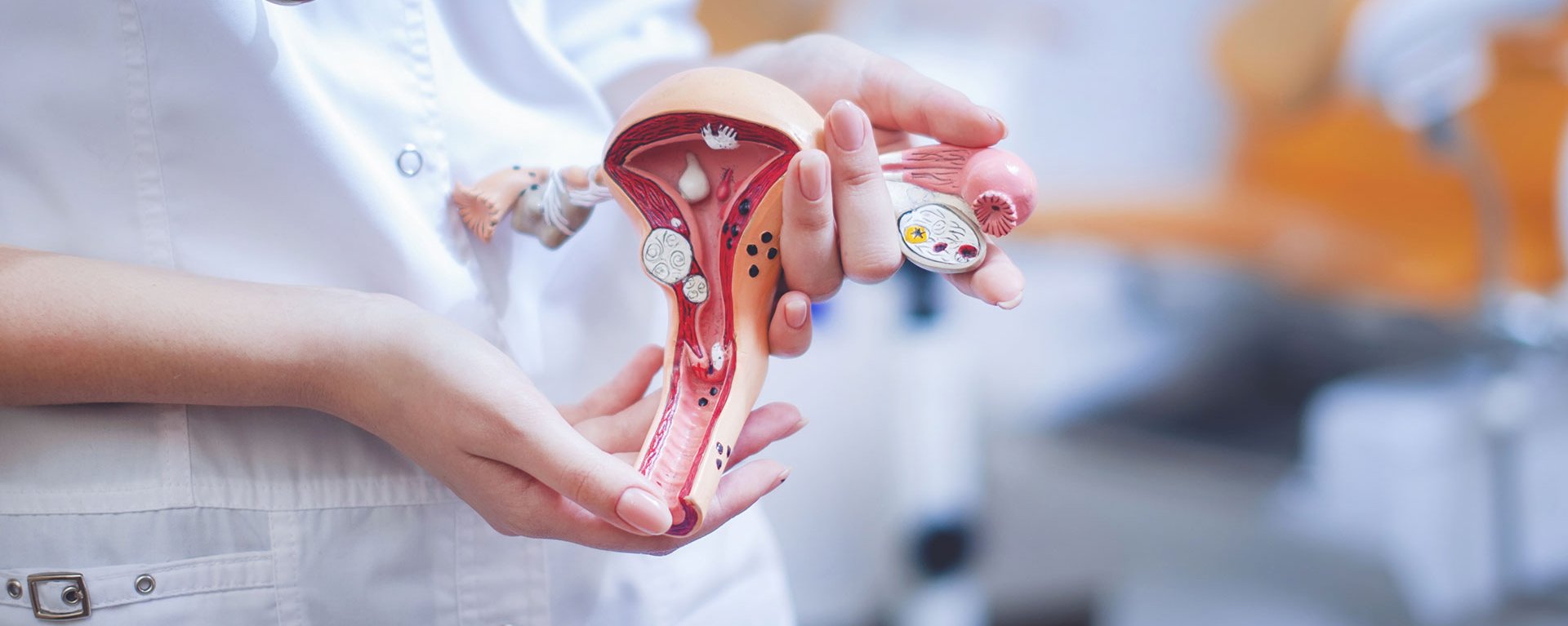 Eine junge Ärztin hält ein Modell des weiblichen Uterus - im Hintergrund ist unscharf ein gynäkologischer Untersuchungsraum zu sehen